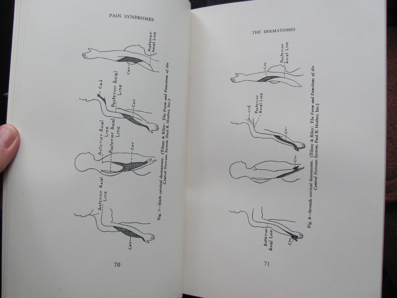 Pain Syndromes Judovich & Bates 1949 3rd Ed 181 Illustrations Medical Book