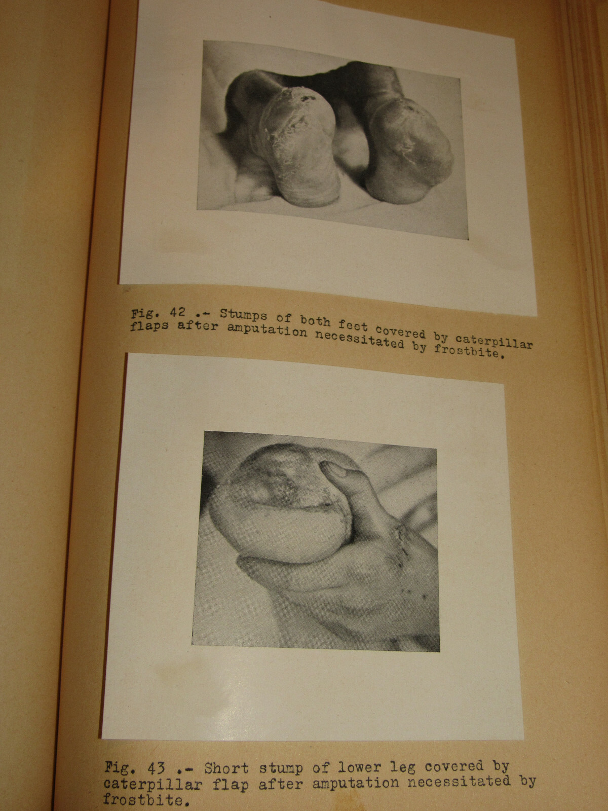 WWII GERMAN ARMY COLD INJURIES BOOK! DR HANS KILLIAN, PICTURES, GRAPHS! VTG RARE