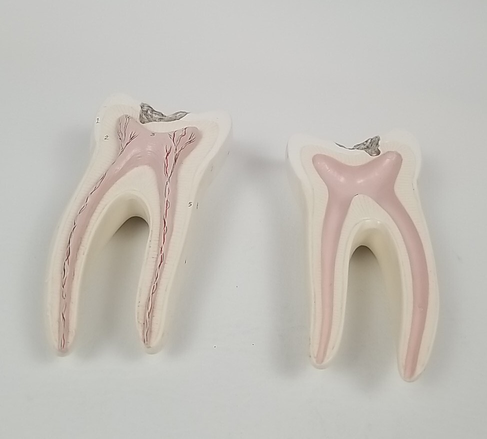 Dental Dentistry Cavity Tooth Sectional 2 Piece Teaching Model Vintage