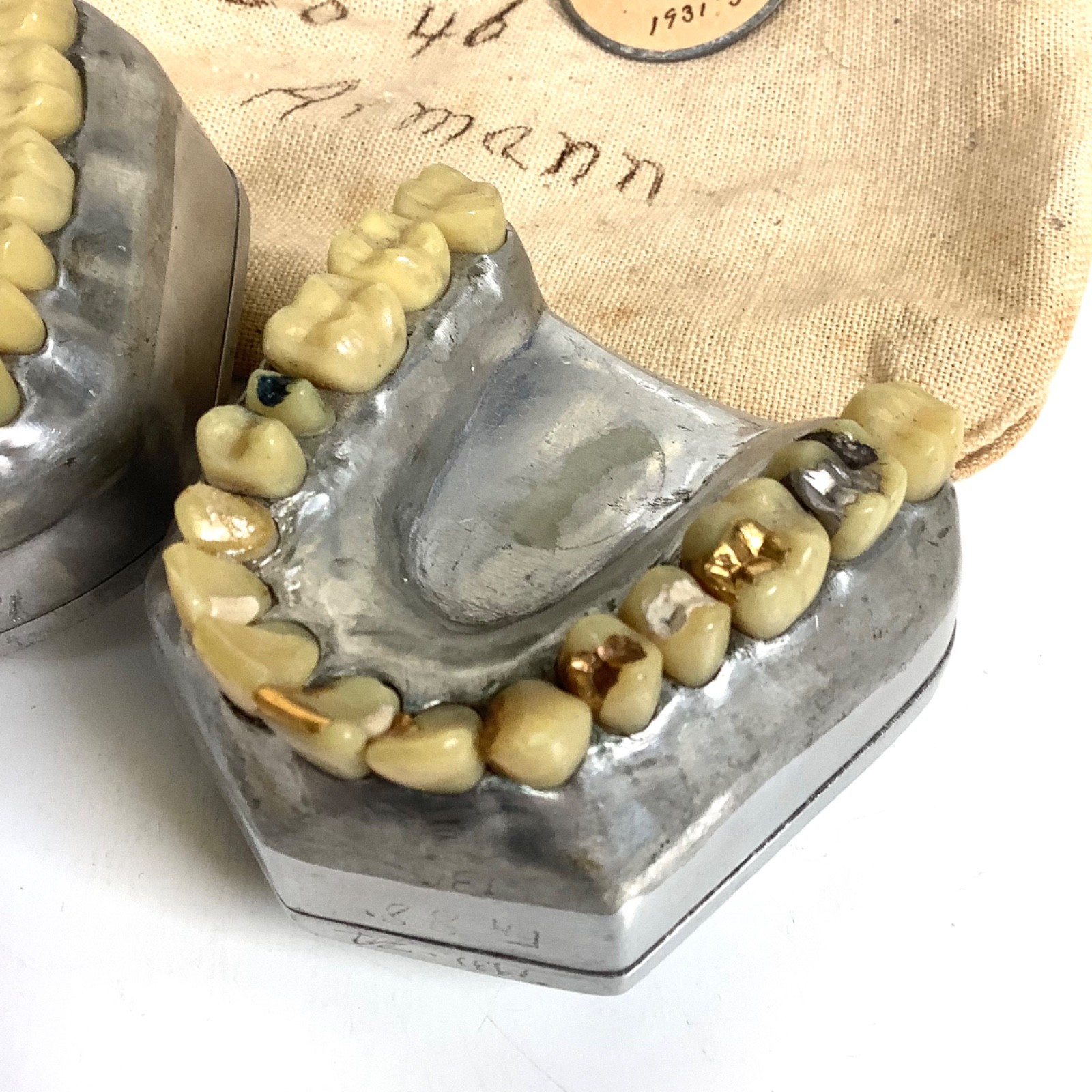 1931 Dental School Teaching Phantoms – Real Teeth w/ GOLD & Silver Restorations