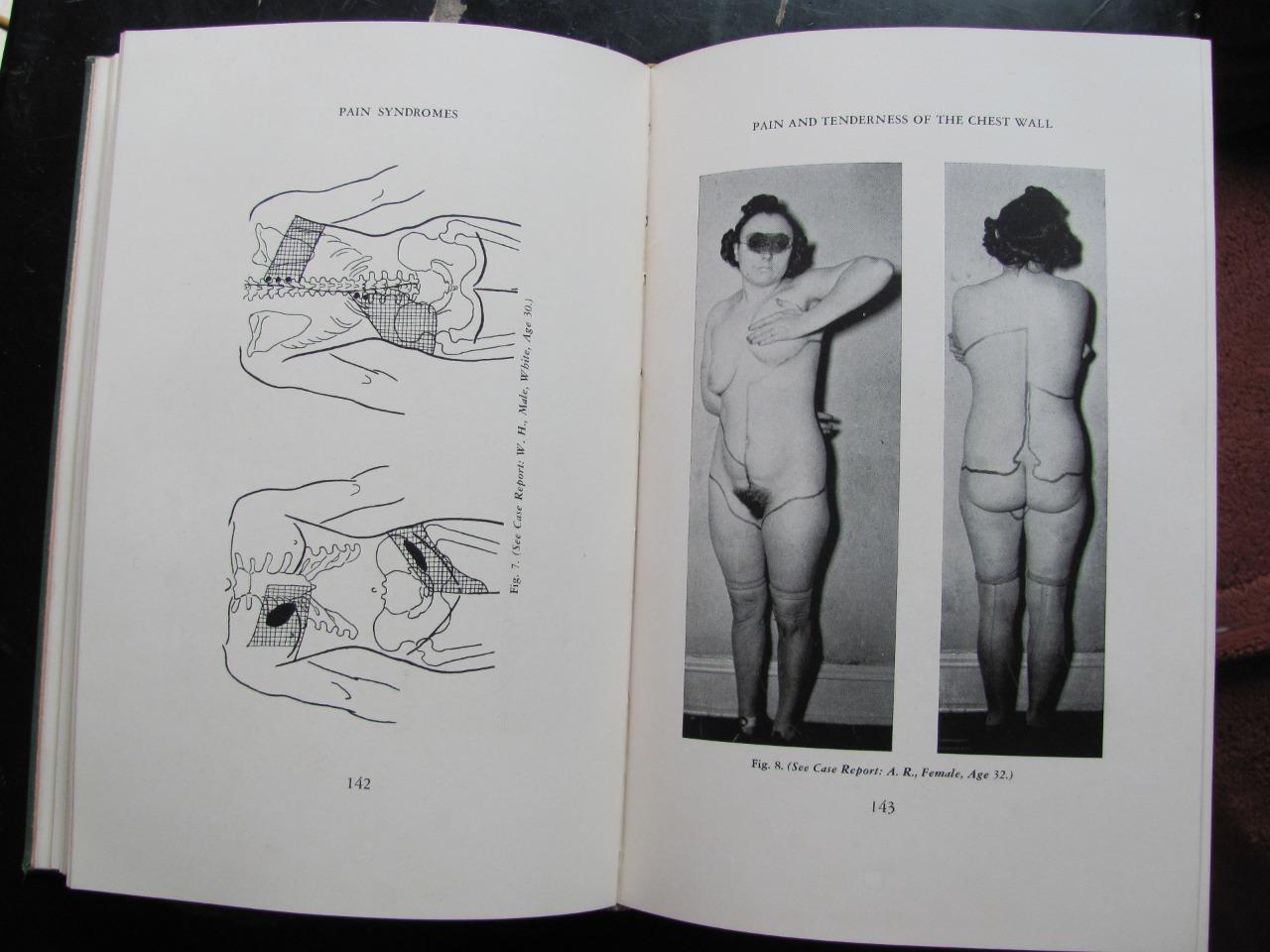 Pain Syndromes Judovich & Bates 1949 3rd Ed 181 Illustrations Medical Book