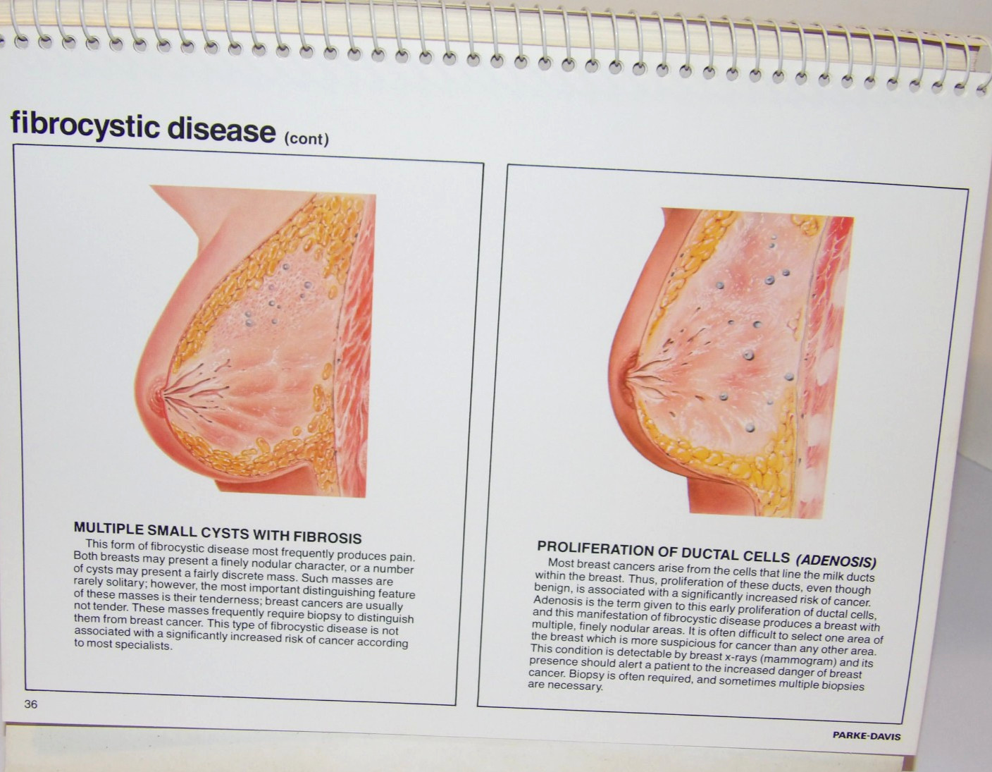 VTG 1978 DOCTOR OFFICE FLIP CHART/BOOK! “FEMALE REPRODUCTIVE ORGANS” PARKE-DAVIS