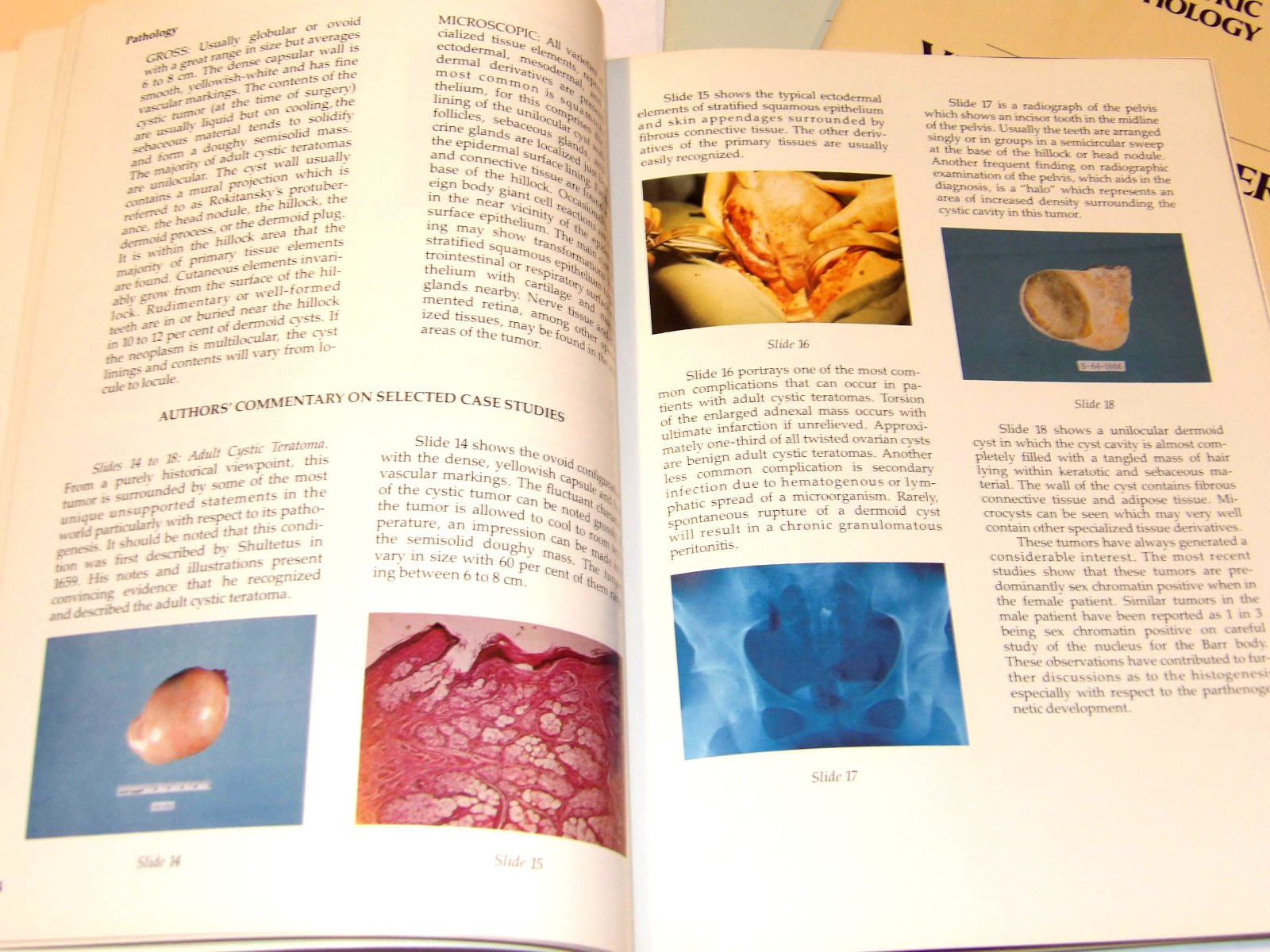 VINTAGE 1981 6 PIECE ATLAS OF GYNECOLOGIC AND OBSTETRIC PATHOLOGY! ILLUSTRATED!
