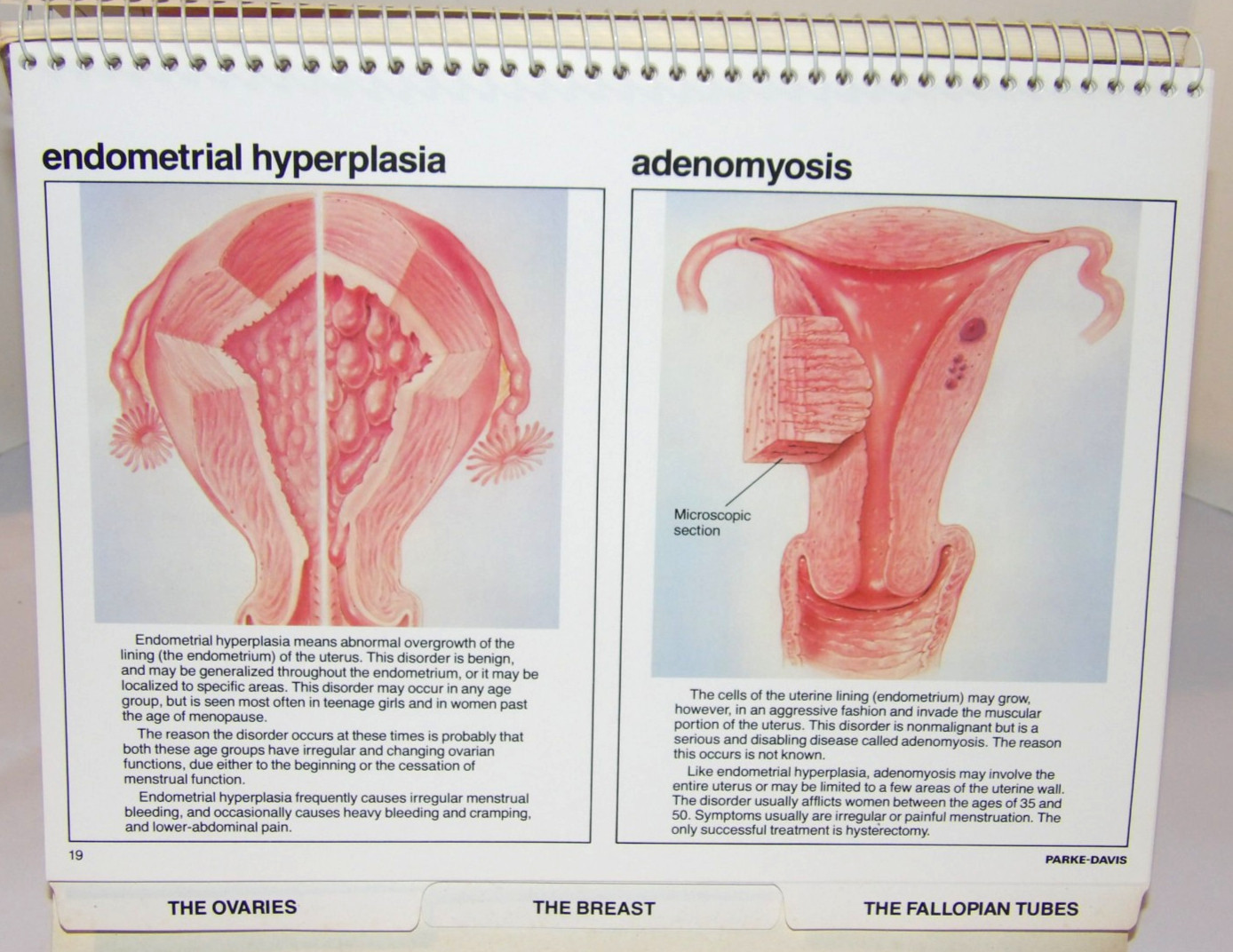 VTG 1978 DOCTOR OFFICE FLIP CHART/BOOK! “FEMALE REPRODUCTIVE ORGANS” PARKE-DAVIS
