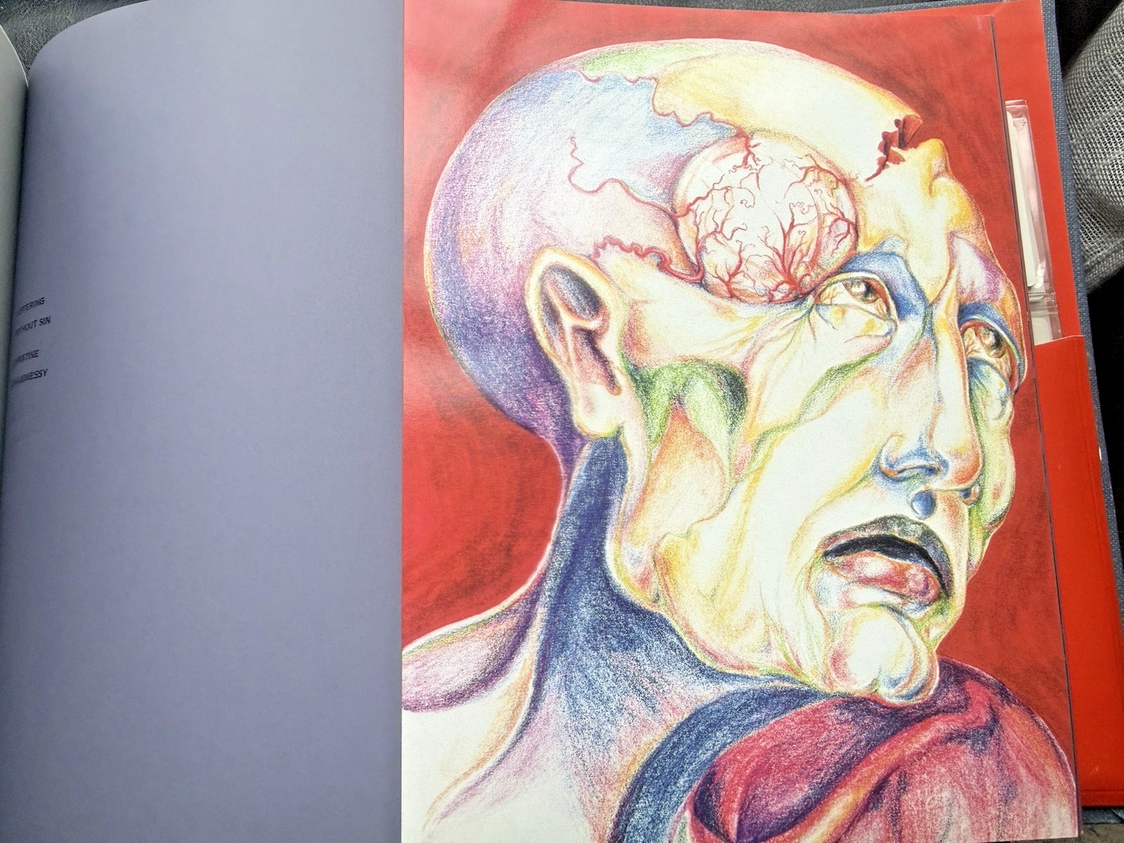 Rare 1982 SANDOZ Migraine Art Book “It’s All In Your Head” + 35mm SLIDES Pharma