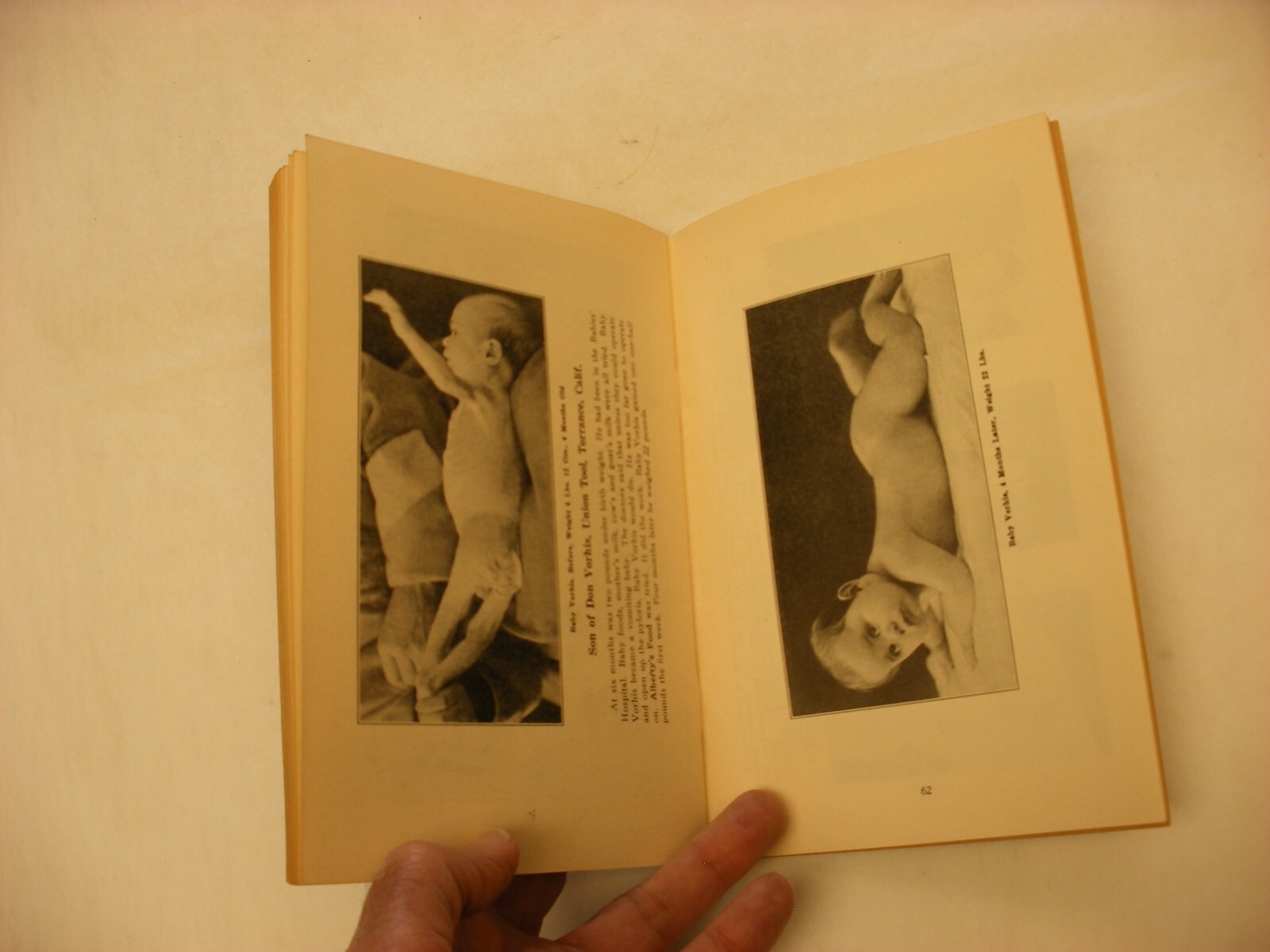 Antique Vtg Quack Medicine Pharmacy Medical Book – 1929 Calcium by Adah Alberty