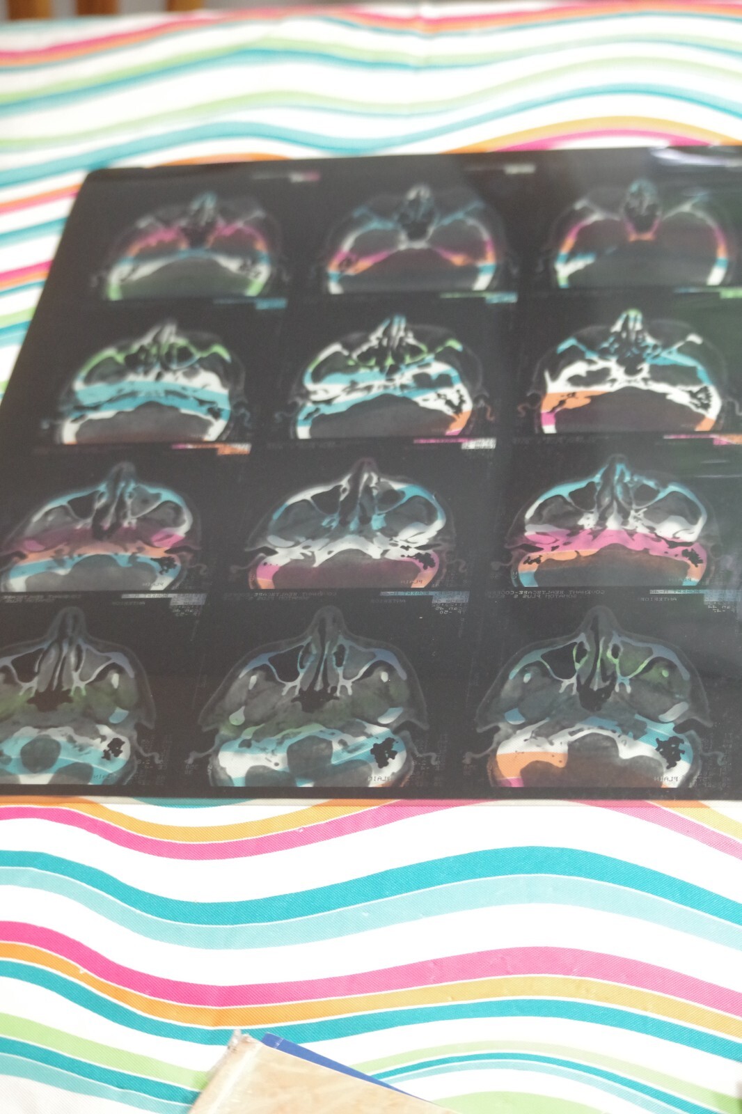 3 Real MRI M. R. I Film Physical Scan Image 17″ X 14″ Medical X-ray
