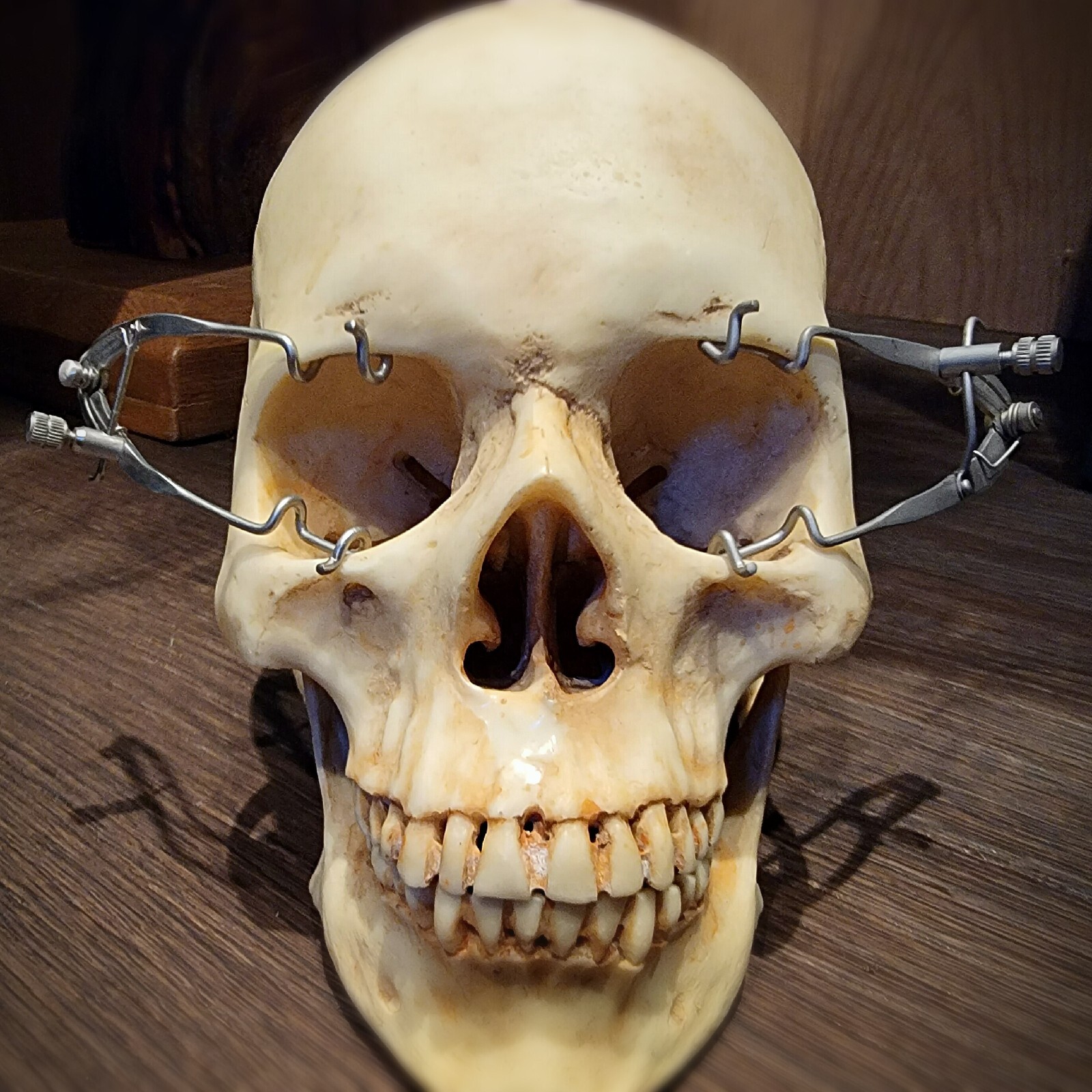 X2 Eye Speculum Set, Vintage Medical Style Eye Spreader, Oddities, Curiosities