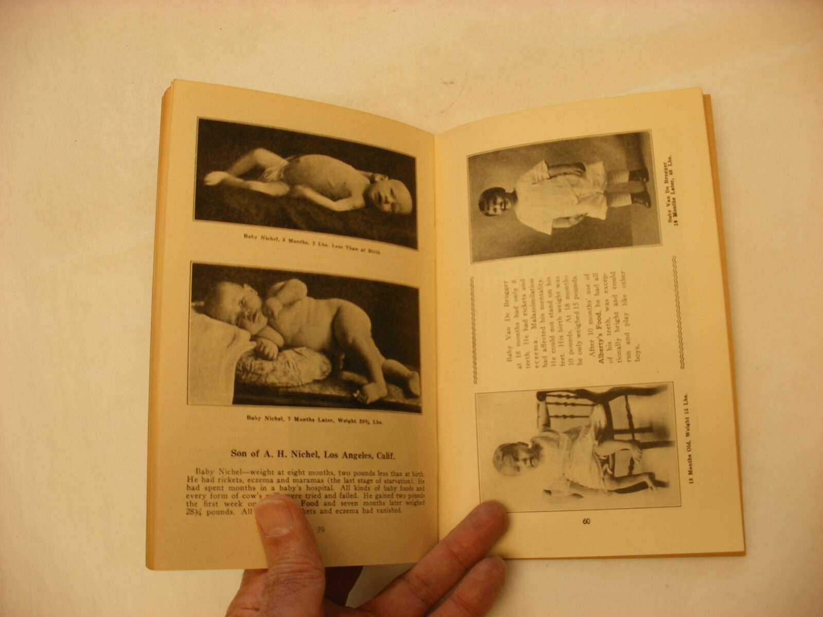 Antique Vtg Quack Medicine Pharmacy Medical Book – 1929 Calcium by Adah Alberty